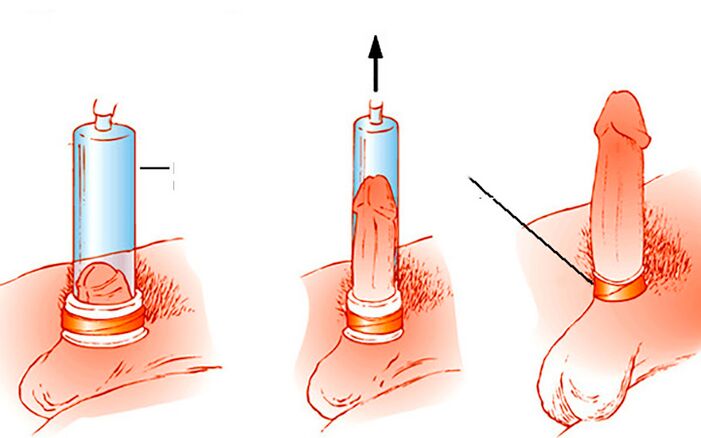 How to operate of the pump