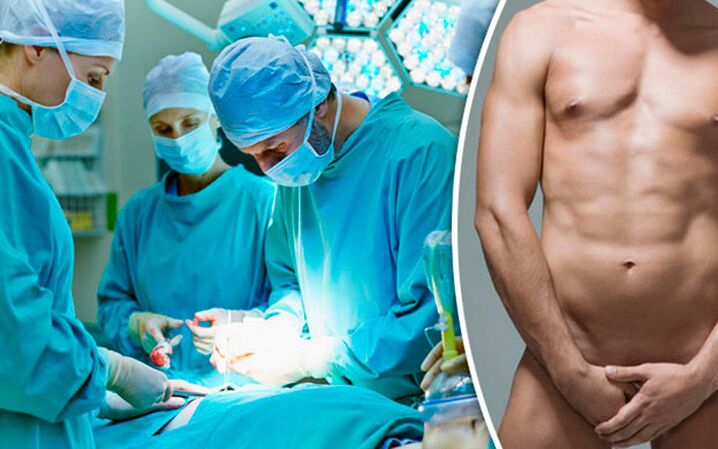 Surgery to increase penis