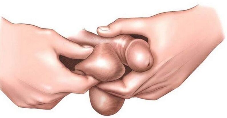 Why do men's private areas itch